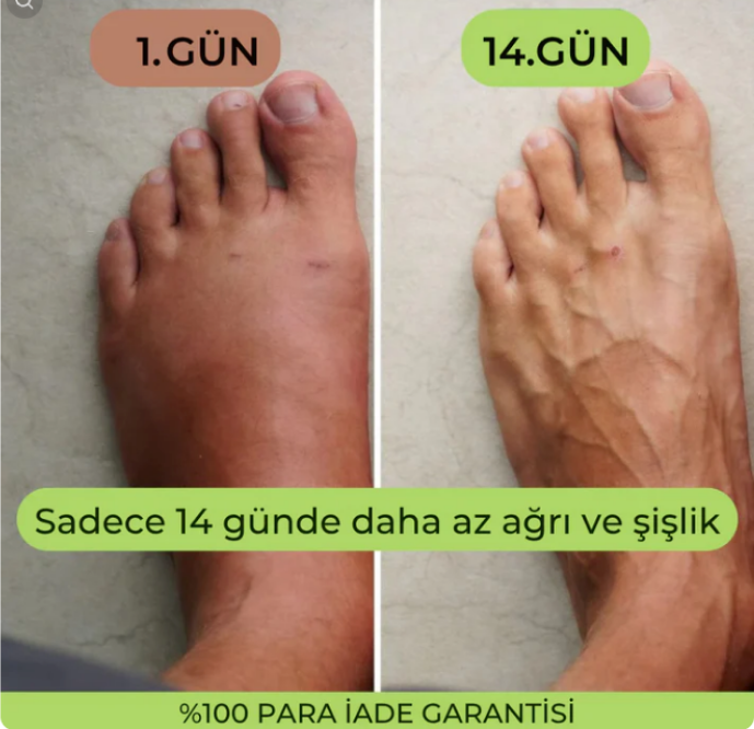 Veluna 3'ü 1 Arada Ayak Masaj Ve Terapi Cihazı