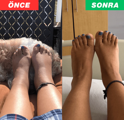 Veluna 3'ü 1 Arada Ayak Masaj Ve Terapi Cihazı